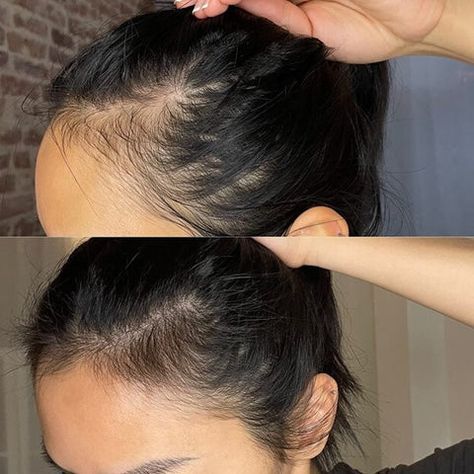 Organic Hair Growth Oil